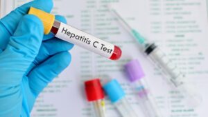 OMS yasabye Isi kwigira ku Rwanda mu kurwanya Hepatite C