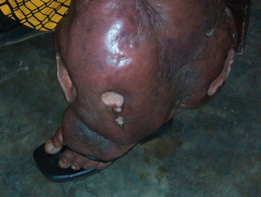 Musanze: Yanzwe n’abe kubera imidido, abona umugabo umuvura intimba