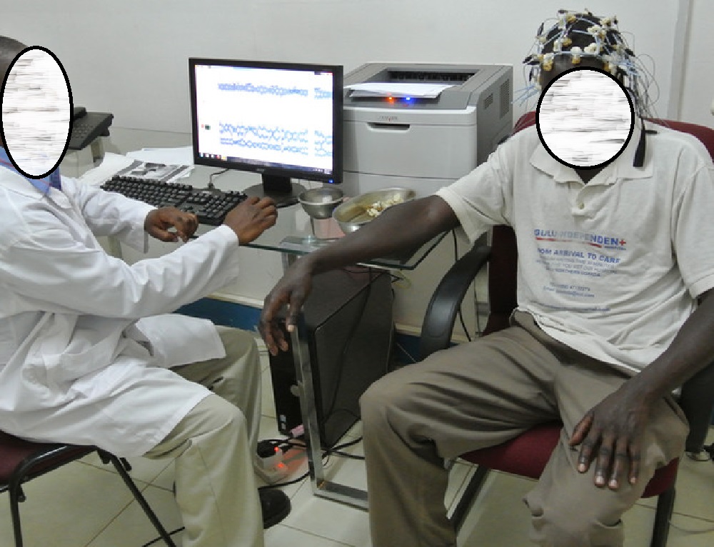 Inzego z’ubuzima zitewe inkeke n’abarwayi b’Igicuri biyongera mu Rwanda