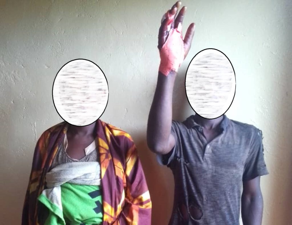 Rusizi:&nbsp; Umugabo yatemwe ikiganza na mukase bapfa ibishyimbo