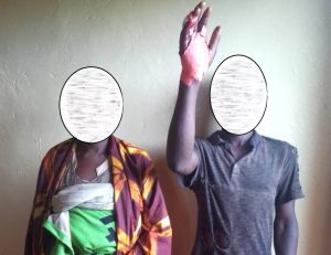 Rusizi:&nbsp; Umugabo yatemwe ikiganza na mukase bapfa ibishyimbo