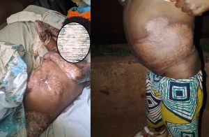Burera: Umubyeyi umaze imyaka 12 avuza abana indwara y’amayobera aratabaza