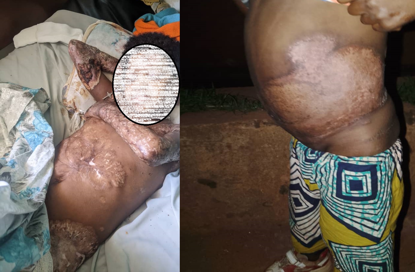 Burera: Umubyeyi umaze imyaka 12 avuza abana indwara y’amayobera aratabaza
