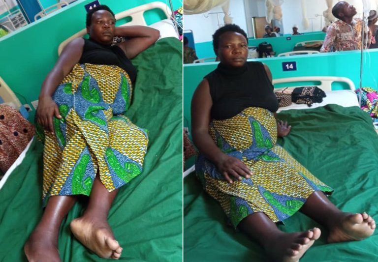 Nyamasheke: Umugore utwite inda y’imvutsi&nbsp;yakubiswe n’inkuba iramutwika