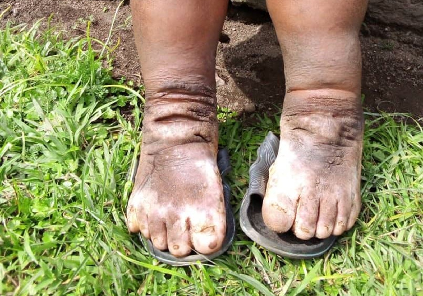 “Imidido ntiterwa n’amarozi cyangwa ubutaka bw’ibirunga”