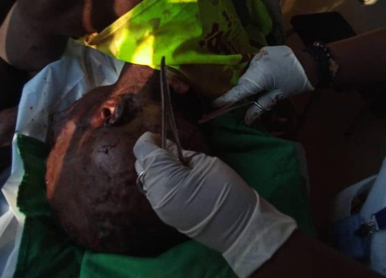 Muhanga: Nyamabuye abagizi ba nabi bakomerekeje uwari uzindukiye mu kazi