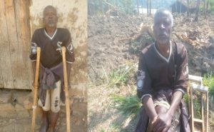 Karongi: Uwavunitse muri COVID-19 agasigarana ubumuga aratabaza