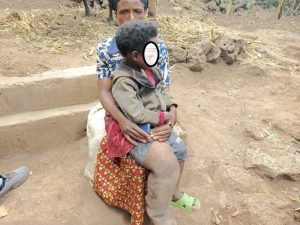 Burera: Ufite umwana wavukanye ubumuga bw’ukuguru akeneye ubufasha bwa miliyoni 5
