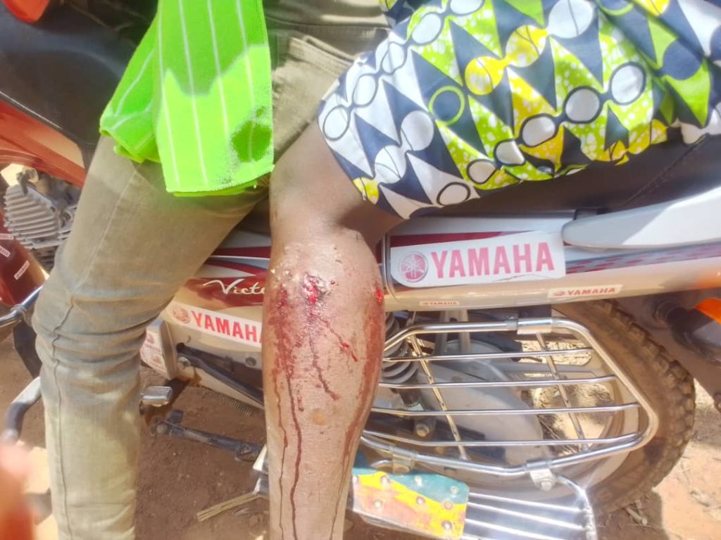 Nyamasheke: Imbwa z’umuturanyi zamusanze mu murima ahinga ziramukomeretsa