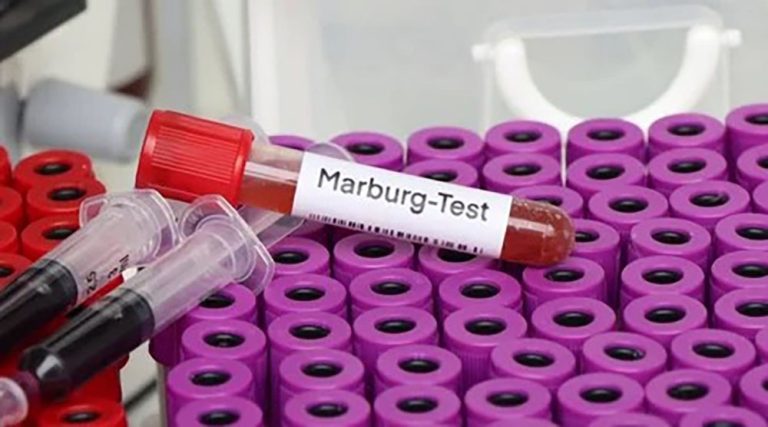 Africa CDC yasabye kongera gusuzuma ibyo kubuza Abanyamerika gusura u Rwanda
