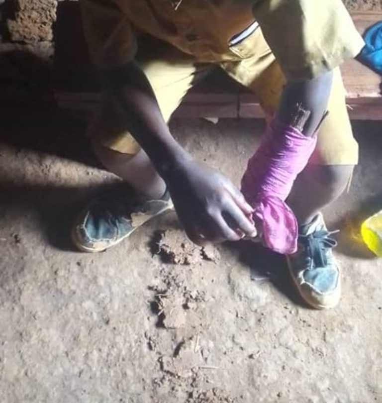 Nyamasheke:  Umunyeshuri yapanze imodoka yagendaga yikubita hasi avunika ukuboko