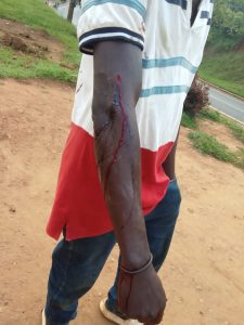 Nyamasheke: Uwateye icyuma umugabo we ku kuboko akamukomeretsa arashakishwa