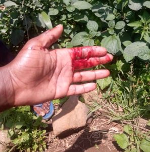 Nyamasheke: Uwangizaga ishyamba rya Leta yakomerekeje SEDO akoresheje umupanga