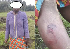 Musanze: Imbogo yavuye muri Pariki ikomeretsa umwangavu
