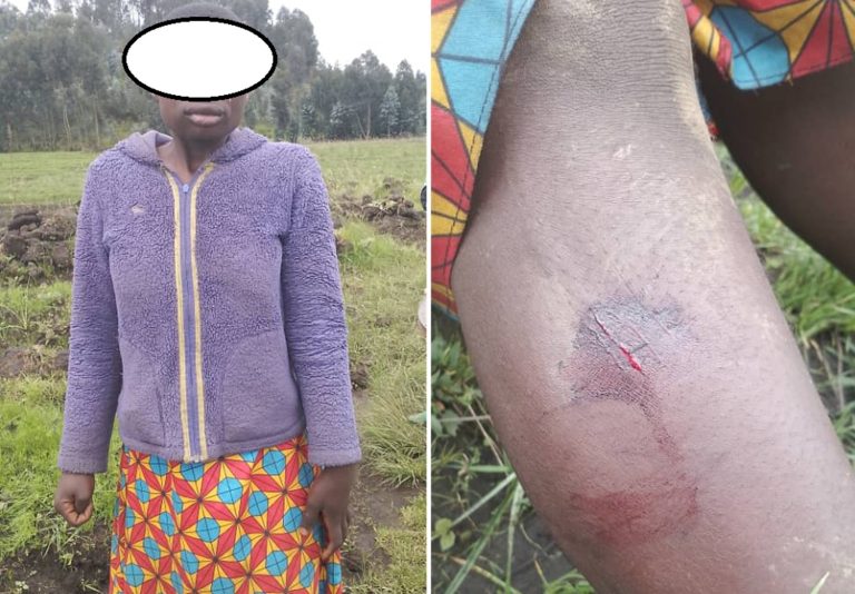 Musanze: Imbogo yavuye muri Pariki ikomeretsa umwangavu