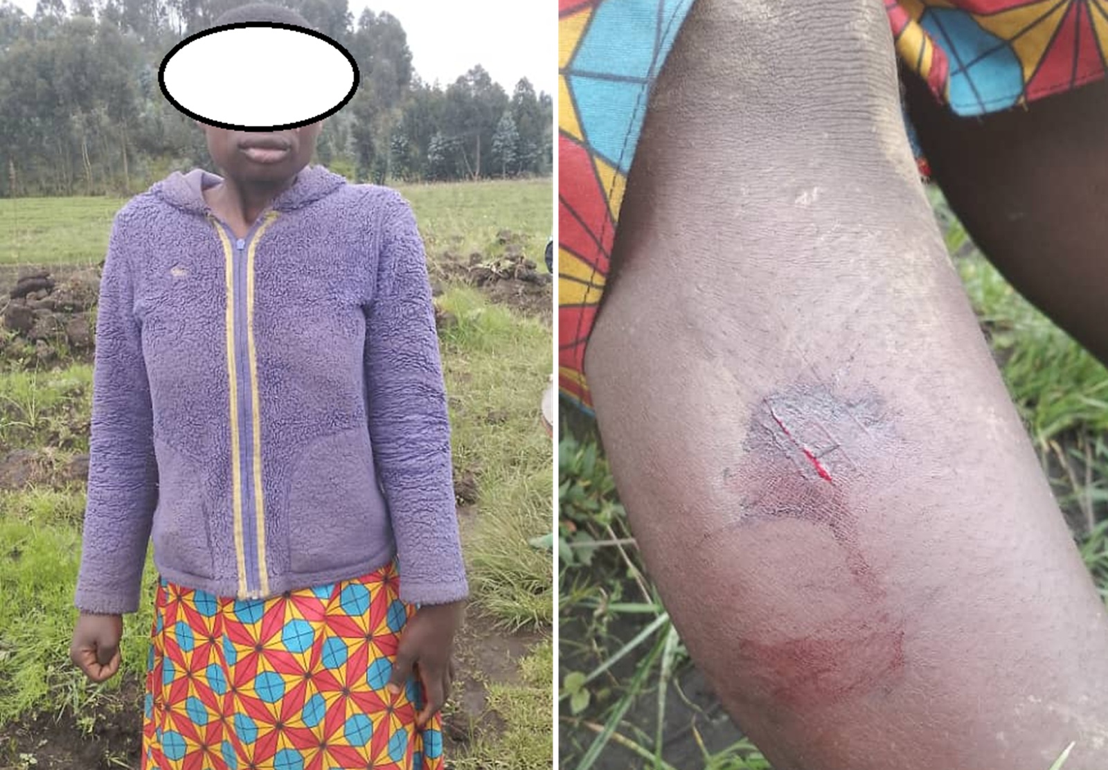 Musanze: Imbogo yavuye muri Pariki ikomeretsa umwangavu