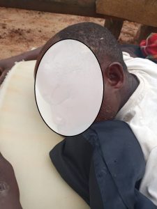 Nyamasheke: Ararembye nyuma yo gukubitwa n’umugore we n’umuhungu wabo