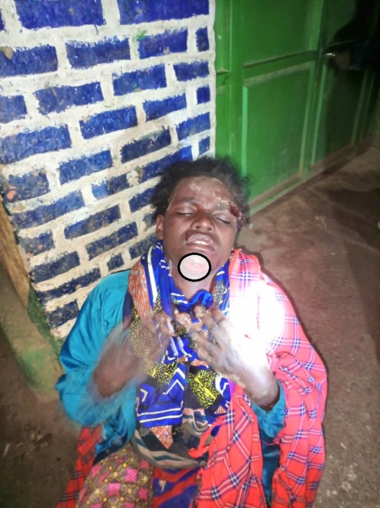 Rutsiro: Yarumye umugore we amwunura akananwa