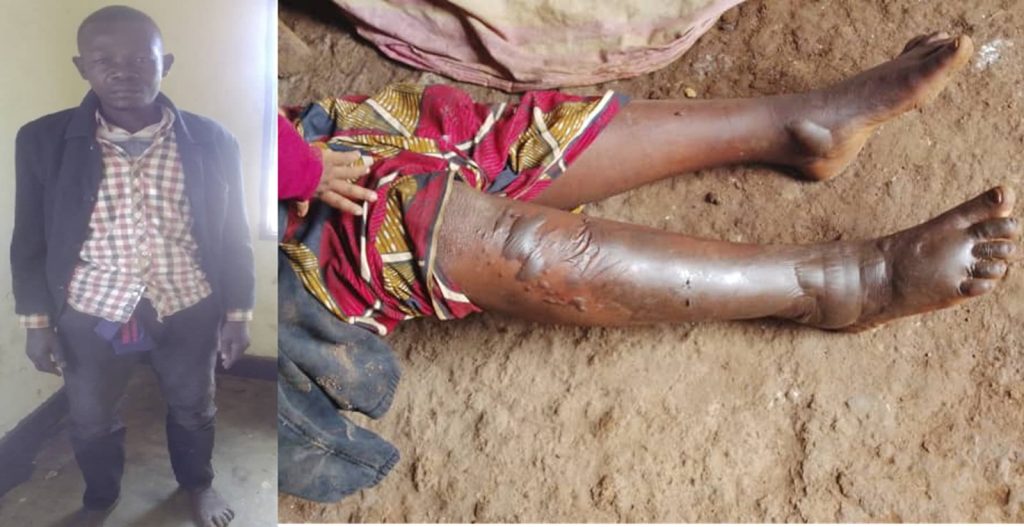 Rusizi: Yatwikishije umugore we amavuta yatuye
