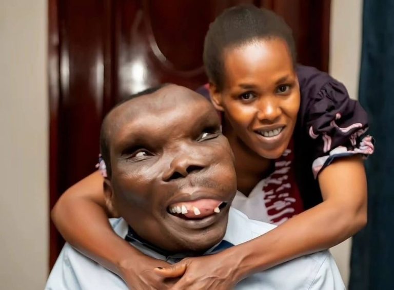 Umugabo mubi ku Isi yizihije imyaka 22 amaranye n’umugore we