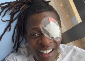 Umuhanzi Jose Chameleone yabazwe ijisho