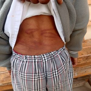 Rubavu: Afungiye gukorera umwana we iyicarubozo 