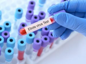 U Bufaransa bwemeje umurwayi wa mbere wa Ebola