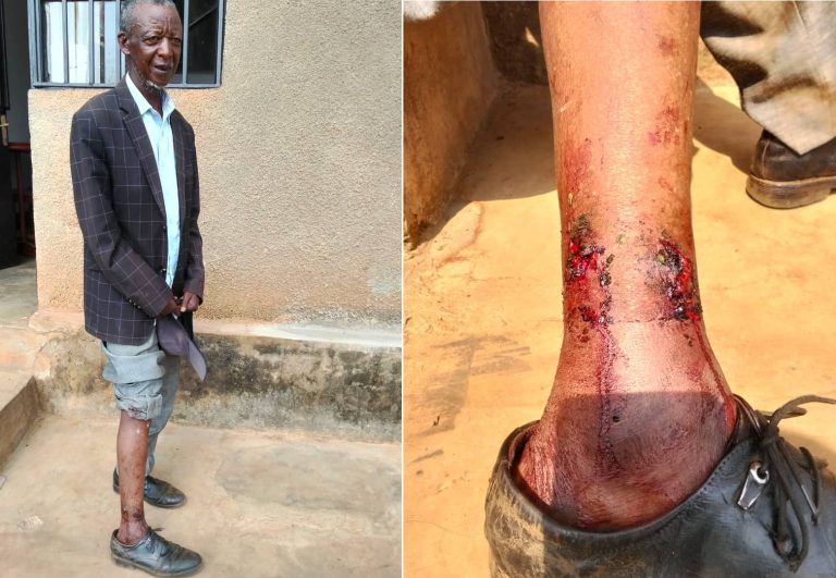 Imbwa z’agasozi zakomerekeje batatu mu nkengero z’Umujyi wa Rusizi